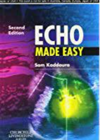 Echo Made Easy, 2E **