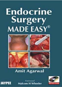 Endocrine Surgery Made Easy (with Photo CD-ROM)