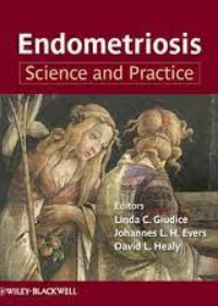 Endometriosis: Science and Practice