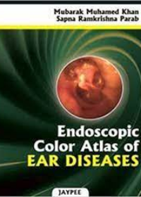 Endoscopic Colour Atlas of Ear Diseases