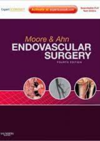 Endovascular Surgery, 4e