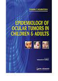 Epidemiology of Ocular Tumors in Children and Adults