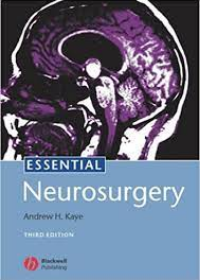 Essential Neurosurgery, 3rd Edition