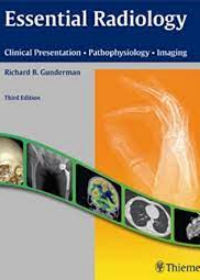 Essential Radiology: Clinical Presentation Pathophysiology Imaging **