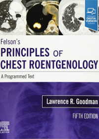 Felson's Principles of Chest Roentgenology, A Programmed Text , A Programmed Text , 5e