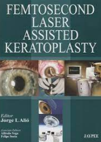 Femtosecond Laser-Assisted Keratoplasty