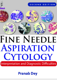 Fine Needle Aspiration Cytology: Interpretation and Diagnostic Difficulties 2e