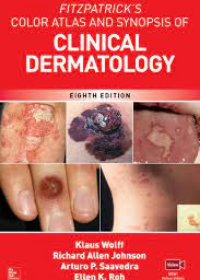 Fitzpatrick's Color Atlas and Synopsis of Clinical Dermatology, 8E