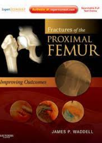 Fractures of the Proximal Femur: Improving Outcomes **