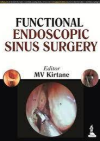 Functional Endoscopic Sinus Surgery