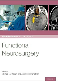 Functional Neurosurgery