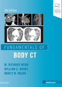 Fundamentals of Body CT , 5e