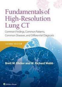 Fundamentals of High-Resolution Lung CT: Common Findings, Common Patterns, Common Diseases and Differential Diagnosis, 2e