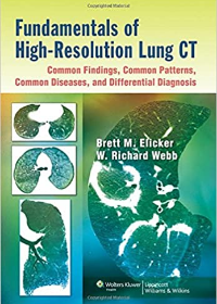 Fundamentals of High-resolution Lung CT: Common Findings, Common Patterns, Common Diseases, and Differential Diagnosis