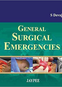 General Surgical Emergencies