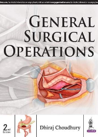 General Surgical Operations, 2e