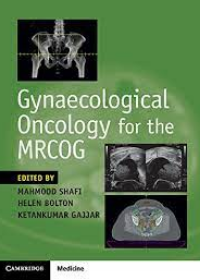 Gynaecological Oncology for the MRCOG