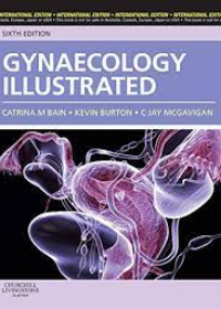 Gynaecology Illustrated, IE, 6e