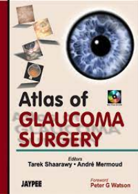 Atlas of Glaucoma Surgery,,1/ed