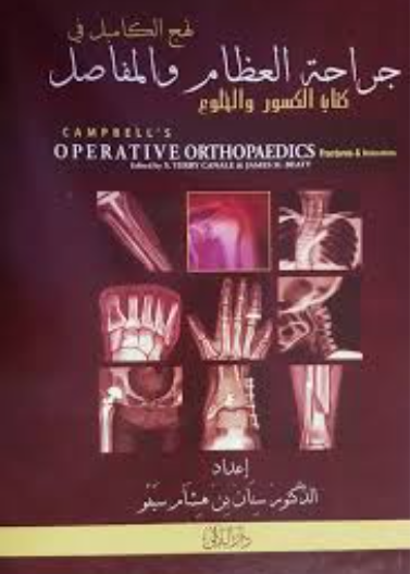 نهج الكامبل في جراحة العظأم والمفاصل (الكسور والخلوع)