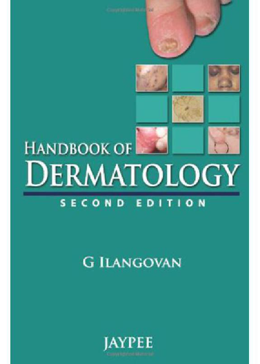 Handbook of Dermatology 2E