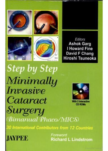 Step by step minimally invasive cataract surgery with int. cd rom 