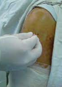 Atlas of Arthroscopic Surgery of the Knee Joint