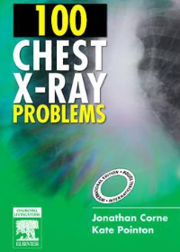 100 Chest X-Ray Problems IE **