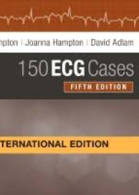 150 ECG Cases, (IE), 5e