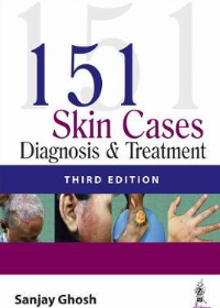 151 Skin Cases Diagnosis & Treatment, 3e