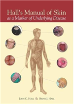 Hall's Manual of Skin: As A Marker of Underlying Disease