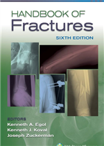 Handbook of Fractures, 6e